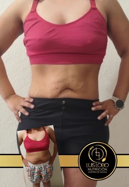 Fotografía de evolución corporal compartida por Luis Lobo Nutrición, vista frontal